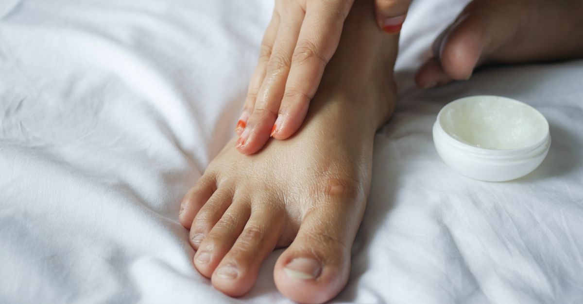 Retrouvez des talons doux : le soin indispensable contre les pieds crevassés