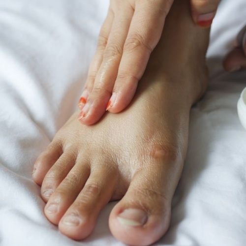 Retrouvez des talons doux : le soin indispensable contre les pieds crevassés